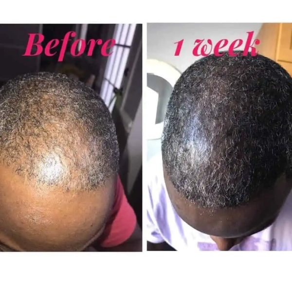 Haircare1
