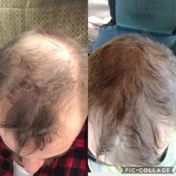 Haircare3
