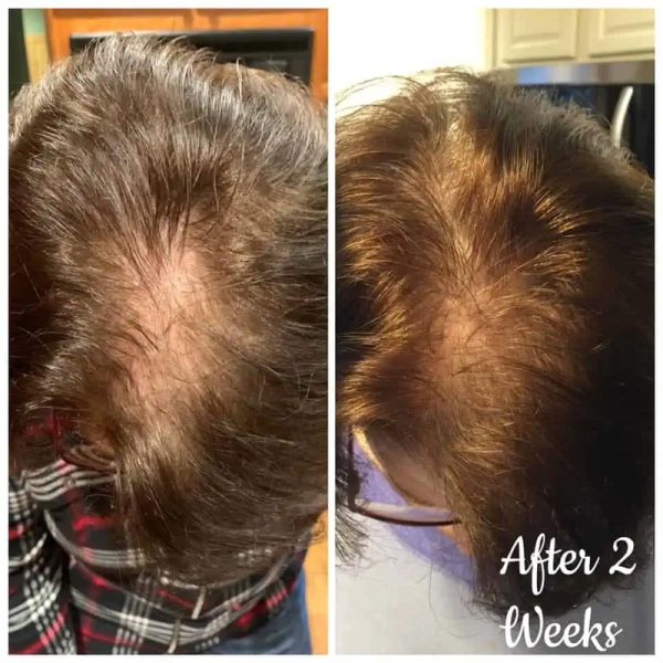 Haircare7