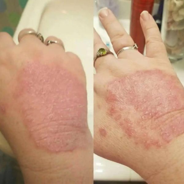 Skincare10