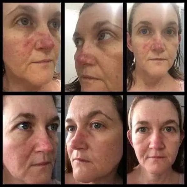 Skincare12
