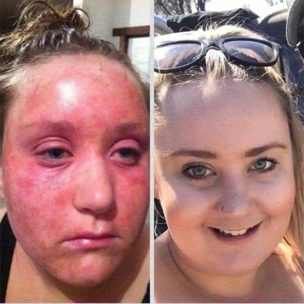 Skincare14
