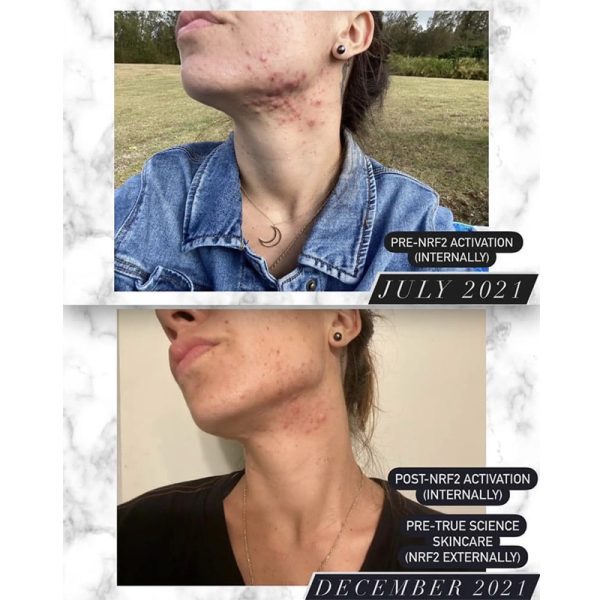 Skincare3
