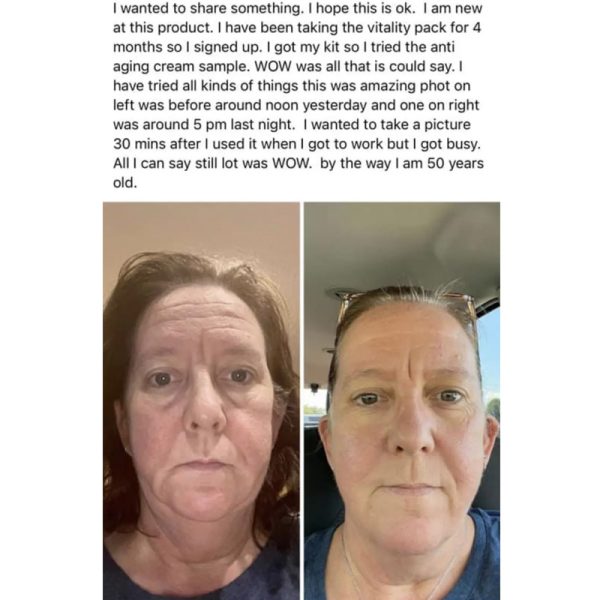 Skincare4