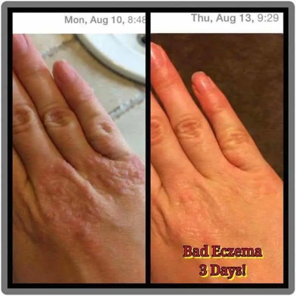 Skincare7