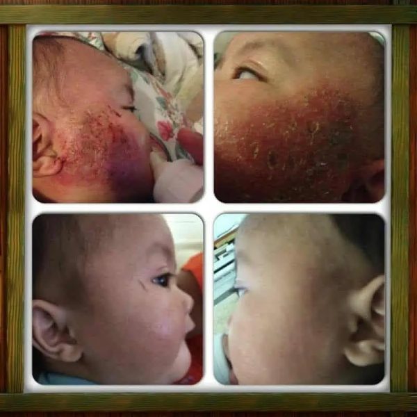 Skincare8