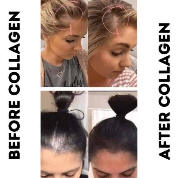 hair